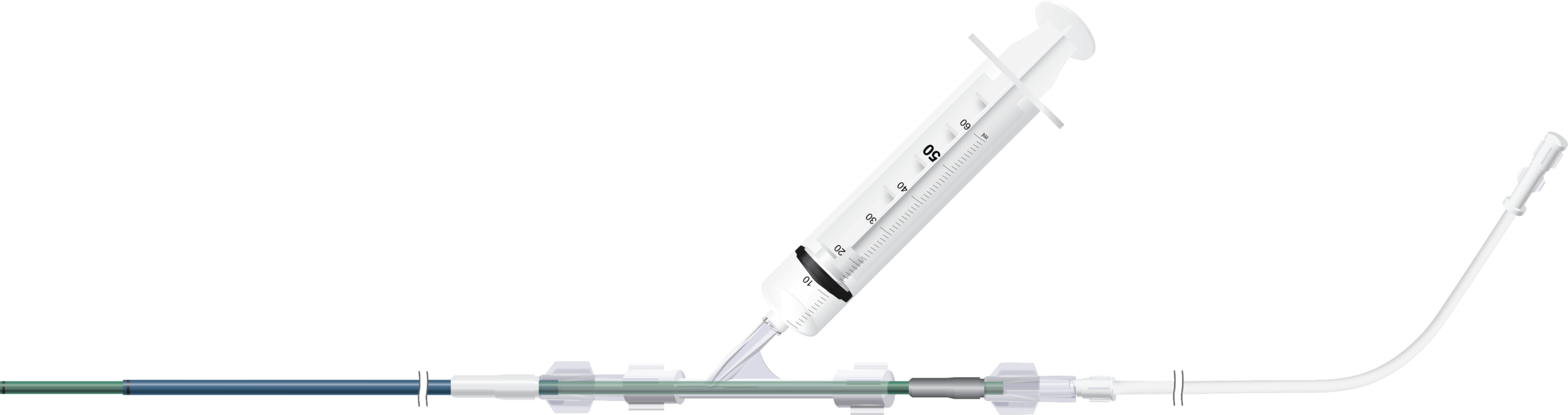 A syringe attached to an aspiration catheter