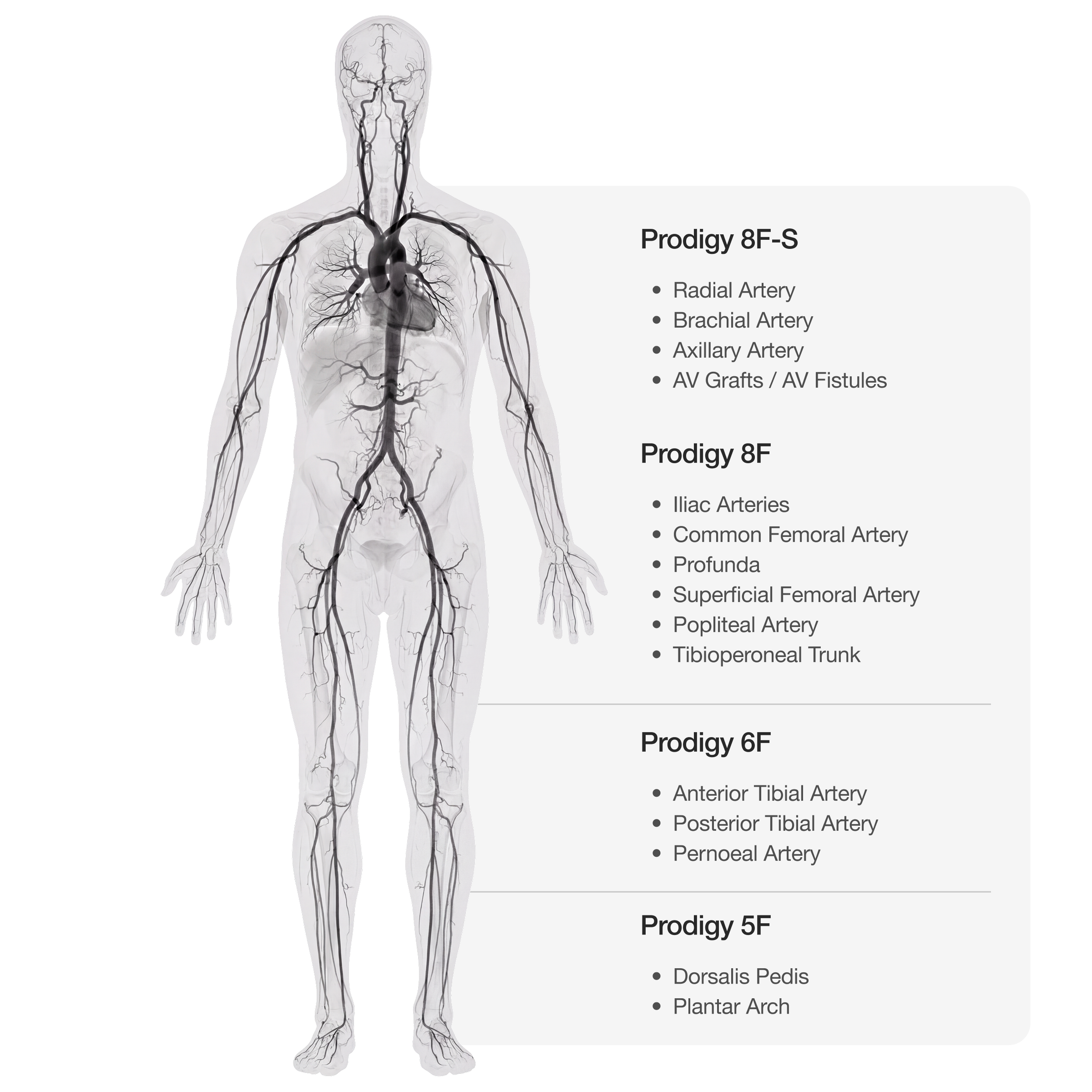 Full-body illustration showing the reach of the Prodigy catheters from head to toe